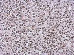 TIP60 Antibody in Immunohistochemistry (Paraffin) (IHC (P))