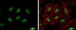 NAB1 Antibody in Immunocytochemistry (ICC/IF)