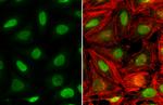 NAB1 Antibody in Immunocytochemistry (ICC/IF)