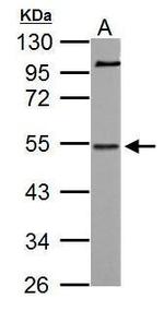 NAB1 Antibody in Western Blot (WB)