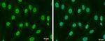 SMAD4 Antibody in Immunocytochemistry (ICC/IF)