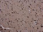 SMAD4 Antibody in Immunohistochemistry (Paraffin) (IHC (P))