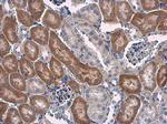 STAT6 Antibody in Immunohistochemistry (Paraffin) (IHC (P))