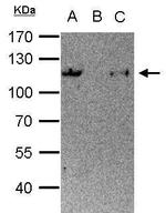 STAT6 Antibody in Immunoprecipitation (IP)