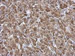 Galectin 3 Antibody in Immunohistochemistry (Paraffin) (IHC (P))