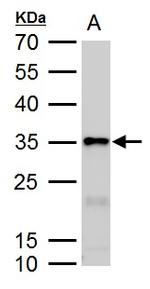 Galectin 3 Antibody in Western Blot (WB)