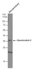 STC2 Antibody in Western Blot (WB)