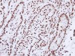 Progesterone Receptor Antibody in Immunohistochemistry (Paraffin) (IHC (P))