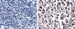 Progesterone Receptor Antibody in Immunohistochemistry (Paraffin) (IHC (P))