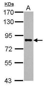 PRMT7 Antibody in Western Blot (WB)