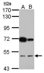 CUG-BP2 Antibody in Western Blot (WB)