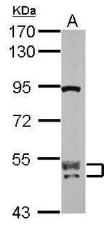 CUG-BP2 Antibody in Western Blot (WB)