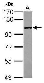 CPSF2 Antibody in Western Blot (WB)