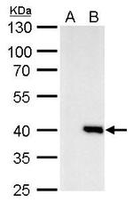 Macro H2A.2 Antibody in Western Blot (WB)