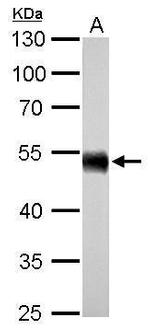 ALDH1A1 Antibody in Western Blot (WB)