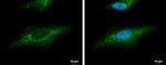 beta Dystroglycan Antibody in Immunocytochemistry (ICC/IF)