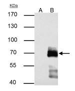 Paxillin Antibody in Immunoprecipitation (IP)