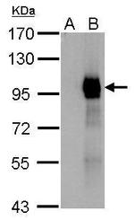 Paxillin Antibody in Western Blot (WB)