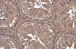 Paxillin Antibody in Immunohistochemistry (Paraffin) (IHC (P))