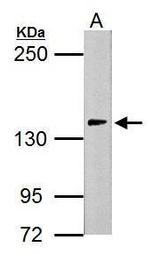 USP7 Antibody in Western Blot (WB)