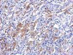 Galectin 3 Antibody in Immunohistochemistry (Paraffin) (IHC (P))