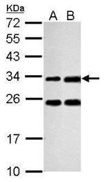 Galectin 3 Antibody in Western Blot (WB)