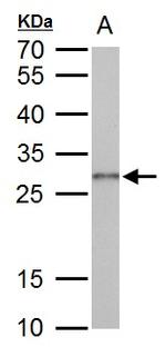 Galectin 3 Antibody in Western Blot (WB)