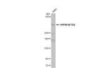 SETD2 Antibody in Western Blot (WB)