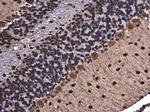 hnRNP A2B1 Antibody in Immunohistochemistry (Paraffin) (IHC (P))