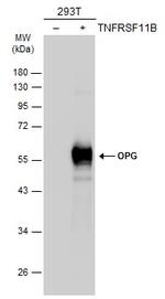 TNFRSF11B Antibody in Western Blot (WB)