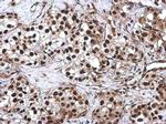 CFDP1 Antibody in Immunohistochemistry (Paraffin) (IHC (P))