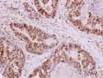 EHMT2 Antibody in Immunohistochemistry (Paraffin) (IHC (P))