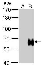 Influenza B HA Antibody in Western Blot (WB)