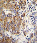 CYP2B6 Antibody in Immunohistochemistry (Paraffin) (IHC (P))