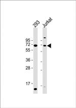 CYP2B6 Antibody in Western Blot (WB)