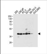 STRA8 Antibody in Western Blot (WB)