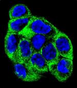 ATP6V1B1 Antibody in Immunocytochemistry (ICC/IF)