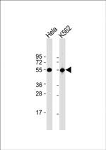 ATP6V1B1 Antibody in Western Blot (WB)