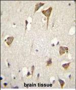 MYO6 Antibody in Immunohistochemistry (Paraffin) (IHC (P))