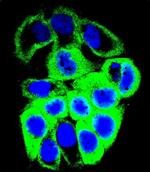 GALNS Antibody in Immunocytochemistry (ICC/IF)