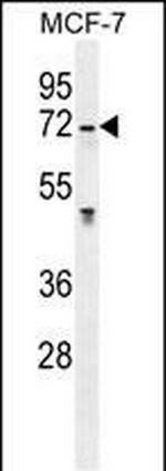 GALNS Antibody in Western Blot (WB)