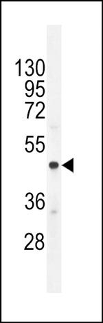 Chromogranin A Antibody in Western Blot (WB)