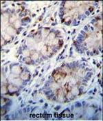 C1QC Antibody in Immunohistochemistry (Paraffin) (IHC (P))