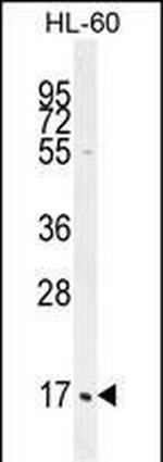 C1QC Antibody in Western Blot (WB)