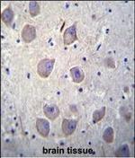 beta Arrestin 1 Antibody in Immunohistochemistry (Paraffin) (IHC (P))