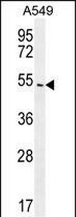 beta Arrestin 1 Antibody in Western Blot (WB)