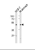 FOXA2 Antibody in Western Blot (WB)