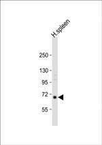 RASGRP2 Antibody in Western Blot (WB)