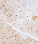 NEU2 Antibody in Immunohistochemistry (Paraffin) (IHC (P))