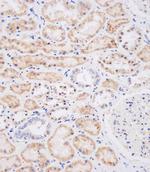 NEU2 Antibody in Immunohistochemistry (Paraffin) (IHC (P))